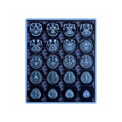Película médica del chorro de tinta del animal doméstico de la pulgada del azul imprimible X Ray Film 11x14 del CE