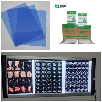 Chorro de tinta médico X Ray Film Blue Base With 280gsm de Digitaces para la prenda impermeable de 14x17inch A4