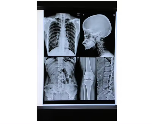 Película de rayos X médica de inyección de tinta azul Película seca médica en hoja A4 o en rollo No hay comentarios todavía