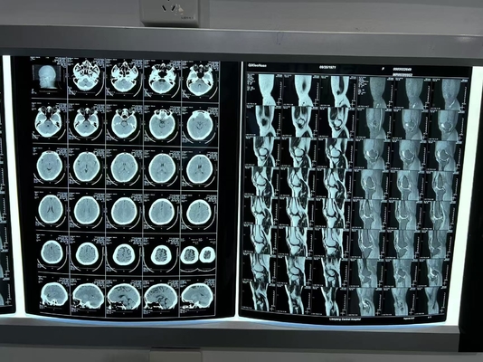Película de impresión térmica de rayos X con láser azul para imágenes radiológicas