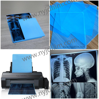 210 micrones de película azul de X Ray Film Medical Inkjet Printing para el hospital