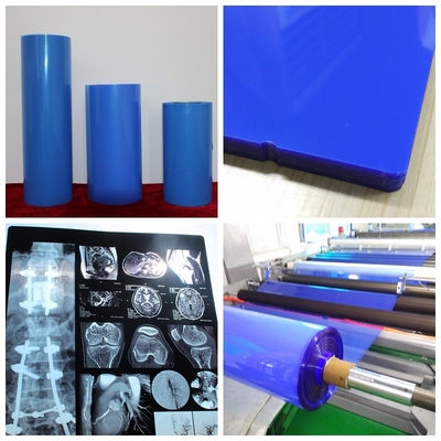 Película de impresión médica del chorro de tinta de la película azul del chorro de tinta ISO9001 el 11*14In