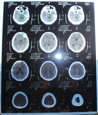 13x17 pulgada Digitaces X Ray Film