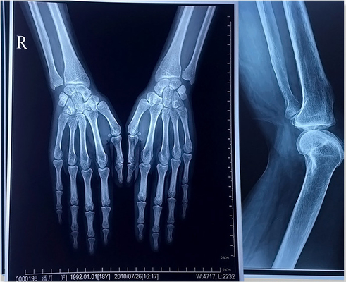 195 película de impresión azul del laser X Ray Film A3 A4 Digitaces del ANIMAL DOMÉSTICO del micrón