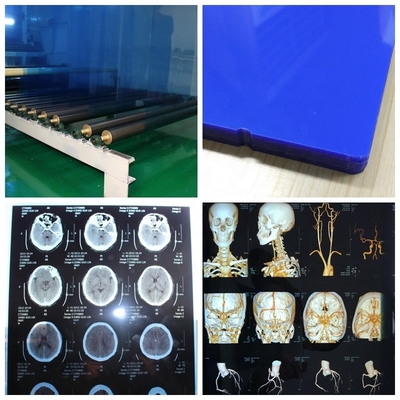ISO 9001 24 películas los 30m médicas de la pulgada X X Ray Film Blue Laser Transparency para los hospitales