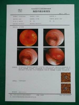 OEM blanco basado ANIMAL DOMÉSTICO del chorro de tinta X Ray Film de la película seca médica de 125um 150um 180um