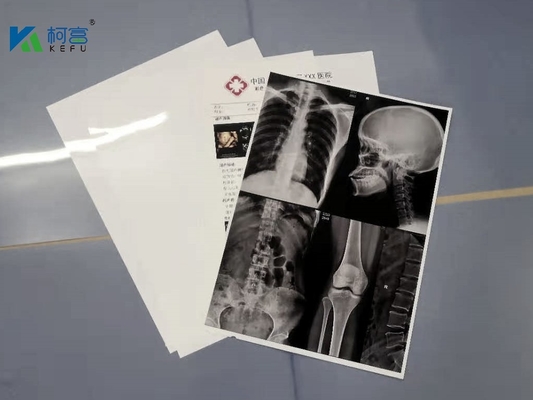 ” 180 micrones blancos de ANIMAL DOMÉSTICO 13X17 X Ray Film Sheets Transparency Film para las impresoras de chorro de tinta