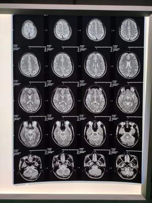 ” 180 micrones blancos de ANIMAL DOMÉSTICO 13X17 X Ray Film Sheets Transparency Film para las impresoras de chorro de tinta