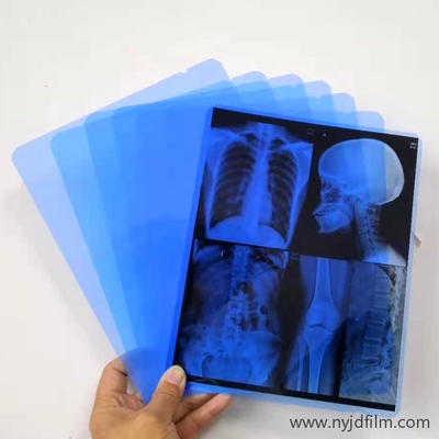 departamento azul del laser X Ray Film For Hospital Radiology de la prenda impermeable de la pulgada 13x17