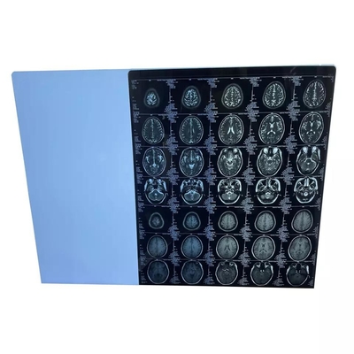 Película seca médica estática anti los 25cmx35cm de la proyección de imagen del laser de Fuji de la película