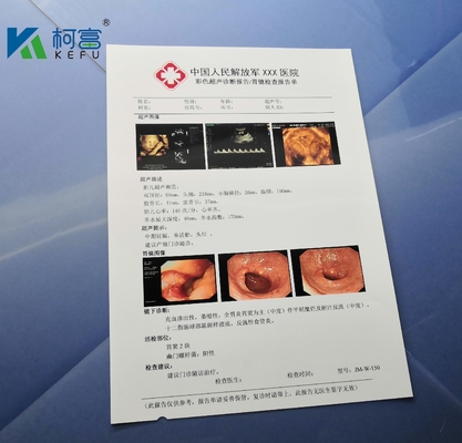 Película brillante blanca del chorro de tinta X Ray Film Medical Dry Imaging de A4 B5 16K 125um