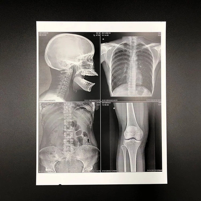 El ANIMAL DOMÉSTICO amistoso de Eco basó el chorro de tinta blanco X Ray Film de la película seca médica 150 micrones