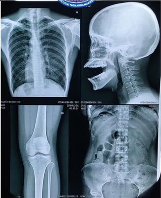 Película médica azul basada ANIMAL DOMÉSTICO del laser de la pulgada de X Ray Film 8x10 para la salida de la imagen de Digitaces