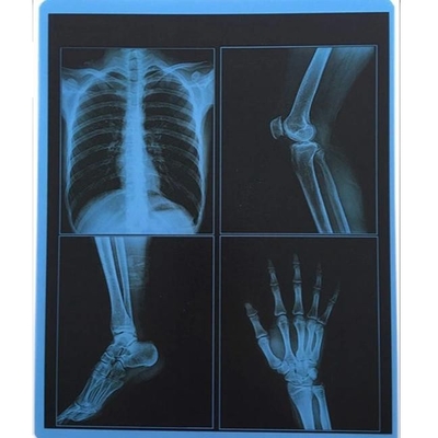 195 micrones ACARICIAN la impresora azul del laser X Ray Film For Fuji OKI de la pulgada de X Ray Film 10x12
