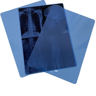 Película azul médica de la impresión por láser de la tinta de la pulgada del ANIMAL DOMÉSTICO X Ray Film 11x14 de la radiología del OEM