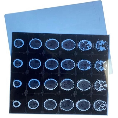 13x17 papel azul seco de la pulgada X Ray Medical Film Blue Transparency para la impresora laser