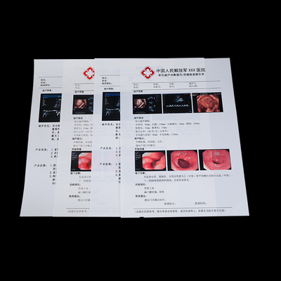 180 micrones no tóxicos de salida médica de X Ray Film For Ultrasound Report