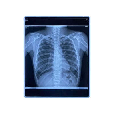 Película médica del chorro de tinta del animal doméstico de la pulgada del azul imprimible X Ray Film 11x14 del CE