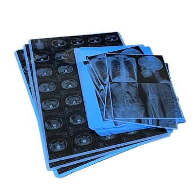 Película de rayos X médica de resina A4 A3 para gráficos de radiología