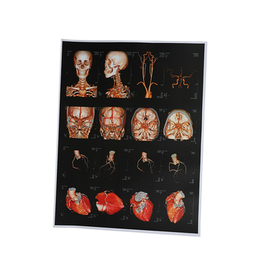 Chorro de tinta X Ray Film del OEM 210um