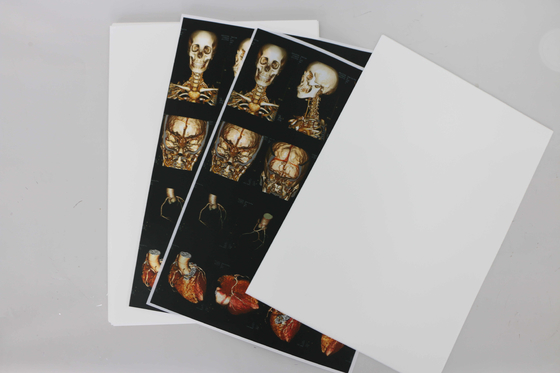 Pulgada de ISO14001 Digitaces X Ray Film Medical X Ray Film 10x12