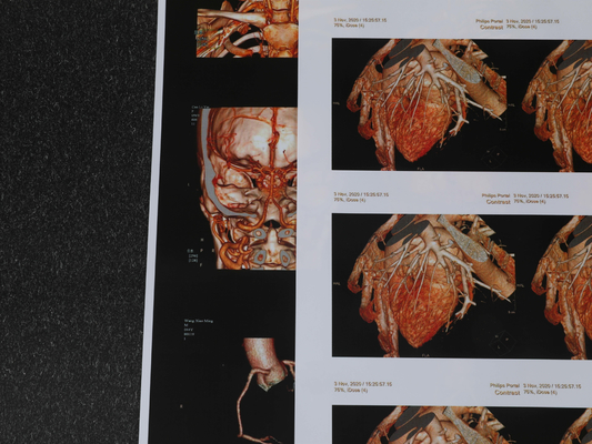 240gsm 180 película médica del pecho de la película 3D CT del chorro de tinta del micrón respetuosa del medio ambiente