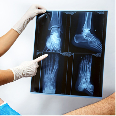 Película de rayos X médica de resina A4 A3 para gráficos de radiología