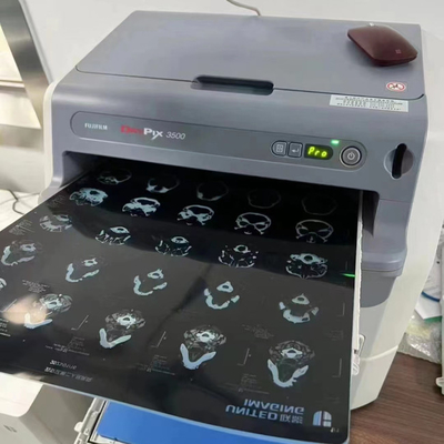 Película de rayos X médica de resina A4 A3 para gráficos de radiología