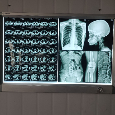 Película de rayos X médica de resina A4 A3 para gráficos de radiología