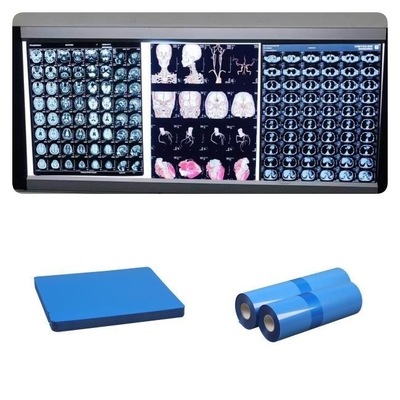 Chorro de tinta médico X Ray Films del dr CT MRI 210 micrones de rollo bajo azul de la tinta 8x10 A4 A3 10inch
