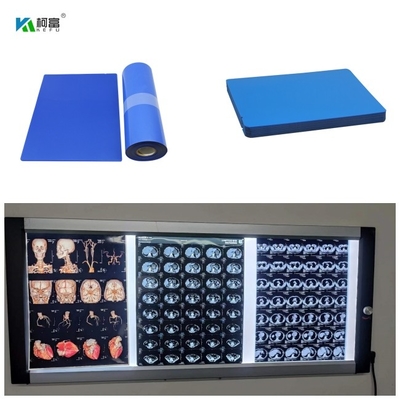 La película 8x10 13x17 14x17 A4 A3 100 del chorro de tinta X Ray Medical Blue Base Dry de 210 micrones cubre