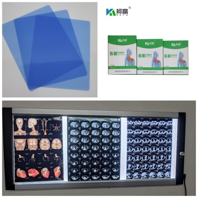 Chorro de tinta médico X Ray Films del dr CT MRI 210 micrones de rollo bajo azul de la tinta 8x10 A4 A3 10inch