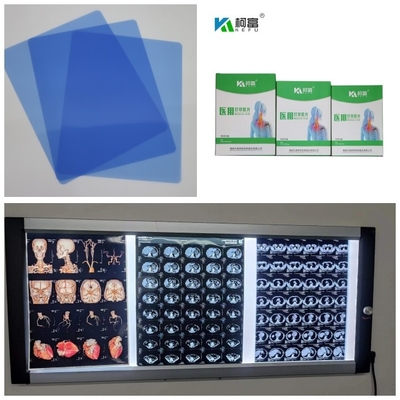 Salida 280gsm X médico Ray Film Inkjet Blue Base para la imagen 10x12 11x14 A4 A3 del dr CT MRI