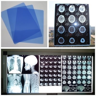 210um casete médico del chorro de tinta X Ray Film Blue For Digital dr CT MRI con las hojas 8x10