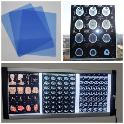 Película seca del chorro de tinta médico bajo azul para Digitaces X Ray Image With 210microns A3 13x17