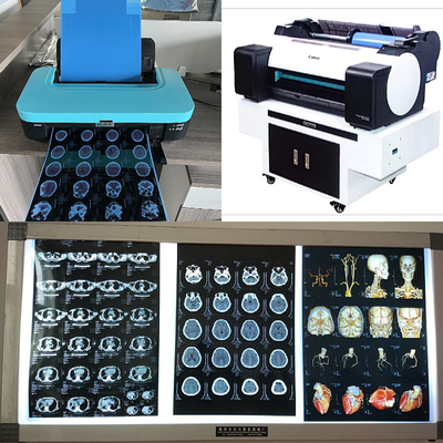 Chorro de tinta médico X Ray Films del dr CT MRI 210 micrones de rollo bajo azul de la tinta 8x10 A4 A3 10inch