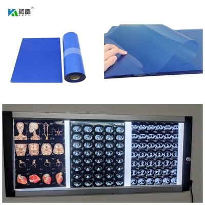Película de inyección de tinta médica de base PET azul con alta estabilidad de imagen con alta resolución