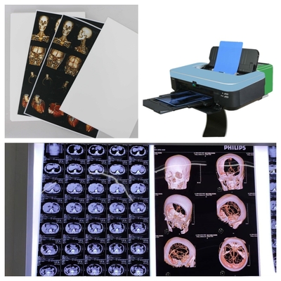 Alta estabilidad de imagen Películas médicas de rayos X 210 micrones Película de Fuji de sustituto azul