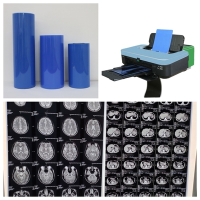 Película de inyección de tinta médica de base PET azul con alta estabilidad de imagen con alta resolución