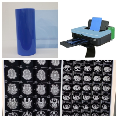 Película de 17 pulgadas de inyección de tinta de rayos X para imágenes médicas 8x10 10x12 11x14 14x17 A4 A3 A3+ 13X17