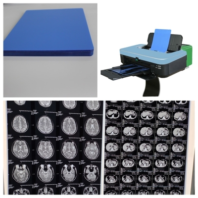 150 micrones de jato de tinta película de rayos X velocidad de impresión 1-3 minutos para el médico 10 pulgadas