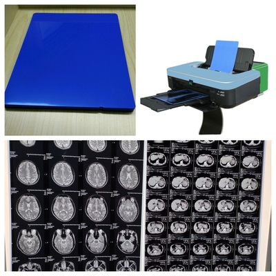 Películas médicas de rayos X de alta resolución 9600x2400dpi con alta estabilidad de imagen