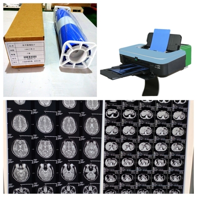 Películas médicas de rayos X con un costo razonable y una alta estabilidad de imagen