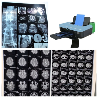 Película de rayos X de color de inyección de tinta de 10 pulgadas para imágenes médicas de 210 micras