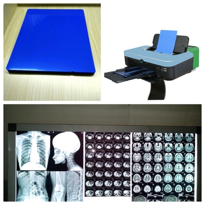 Hojas de película de rayos X de inyección de tinta 8x10 10x12 11x14 14x17 A4 A3 A3+ 13X17 Con velocidad de impresión 1-3 minutos