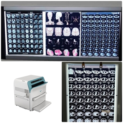 Película de rayos X médicos de niebla baja con resolución de 320 dpi 14 x 17 en la caja de visualización de películas de rayos X Led