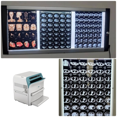 Película seca de rayos X de alta resolución 10x12 para DR CT MRI DSA Salida de imagen Compatible con la impresora Fuji