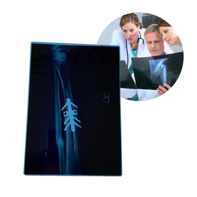 Impresora térmica médica seca Impresora de tomografía computarizada Película de inyección de tinta Azul A4 PET Equipo médico ortopédico Películas de rayos X