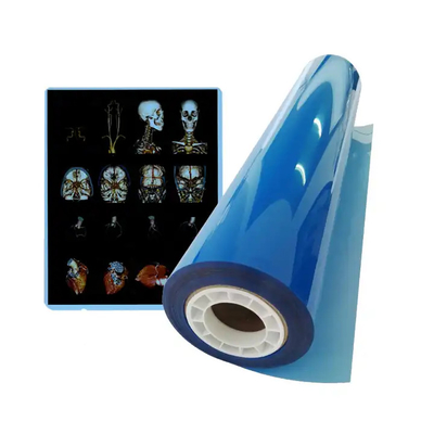 Película de rayos X médica azul avanzada para obtener imágenes claras y precisas