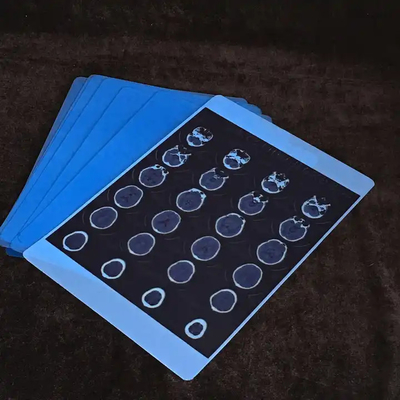 Película de rayos X médica azul avanzada para obtener imágenes claras y precisas